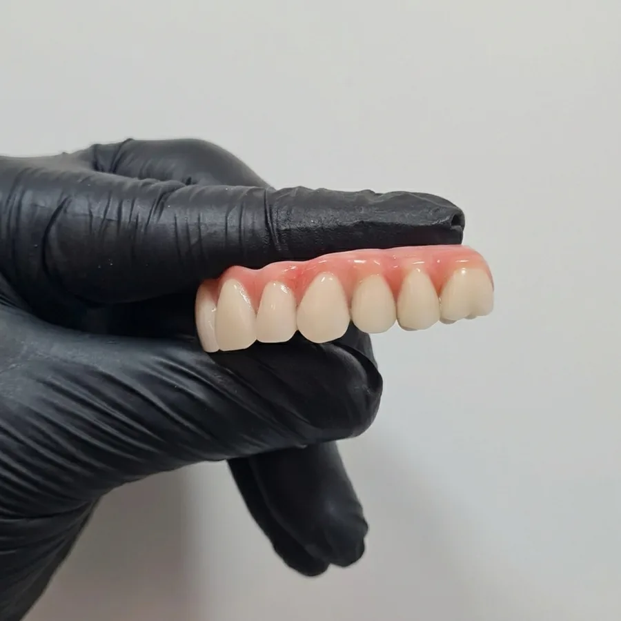 Prótese Protocolo - Dentadura Fixa