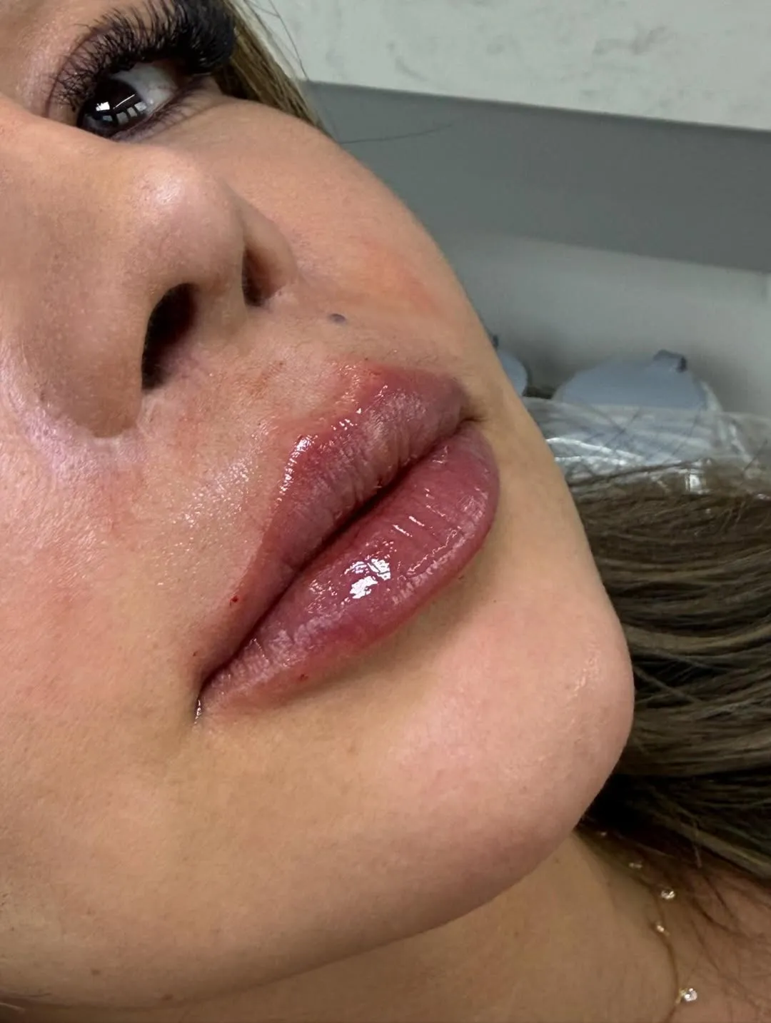 Close preenchimento labial