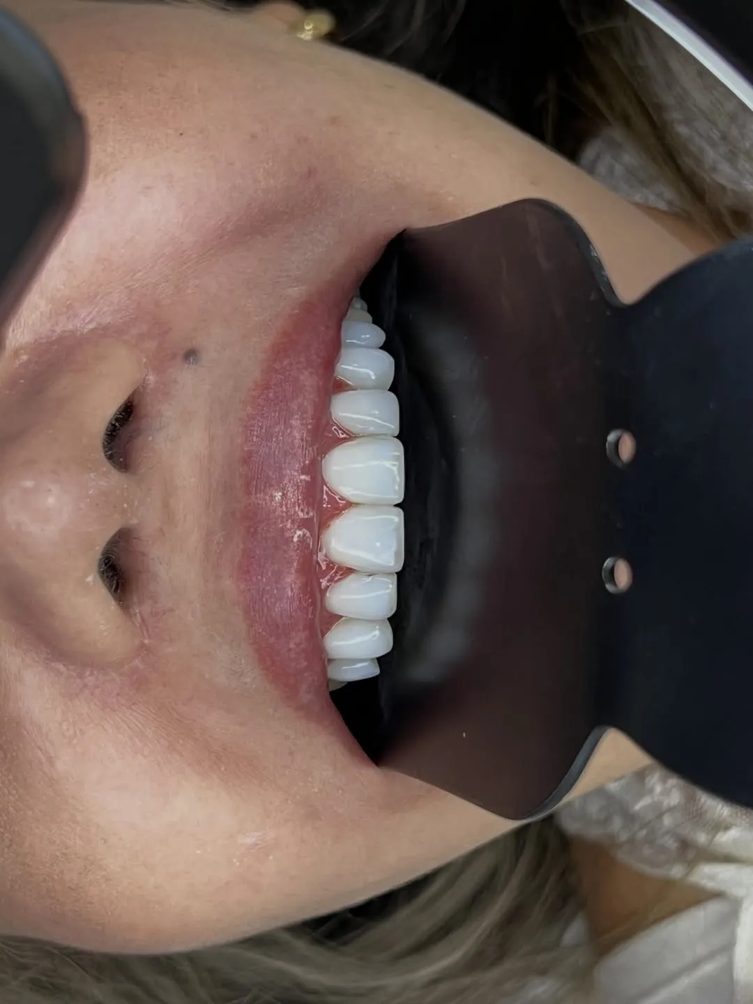 Dentes brancos