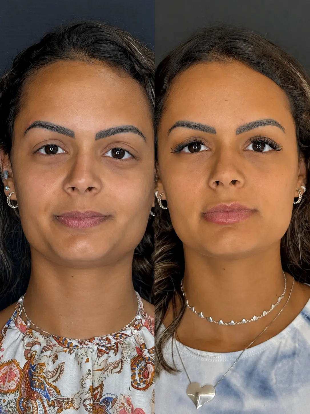 Estética Corporal