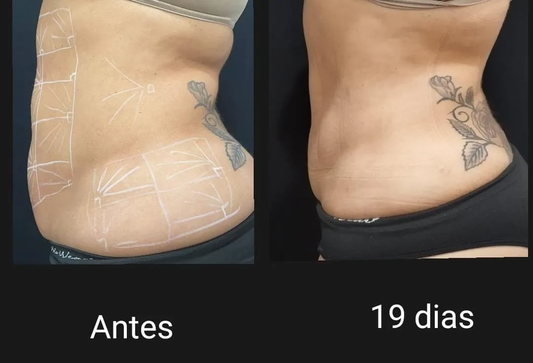Resultado 2